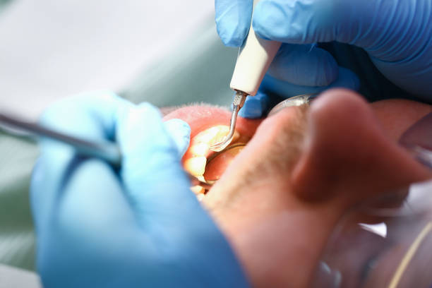 Best Weekend Emergency Dentist in Harristown, IL