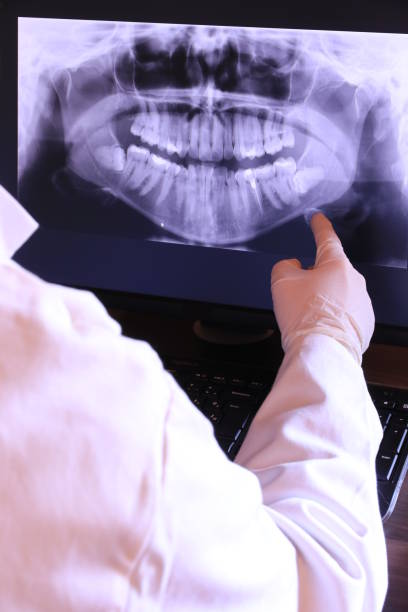 Best Emergency Dental Care for Broken or Chipped Teeth in Harristown, IL